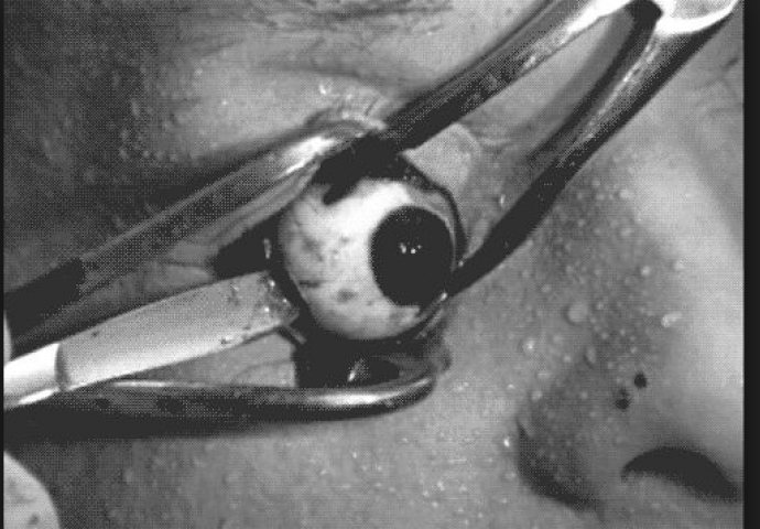 Najstrašniji eksperiment kojeg je osmislio ljudski um ledi krv u žilama