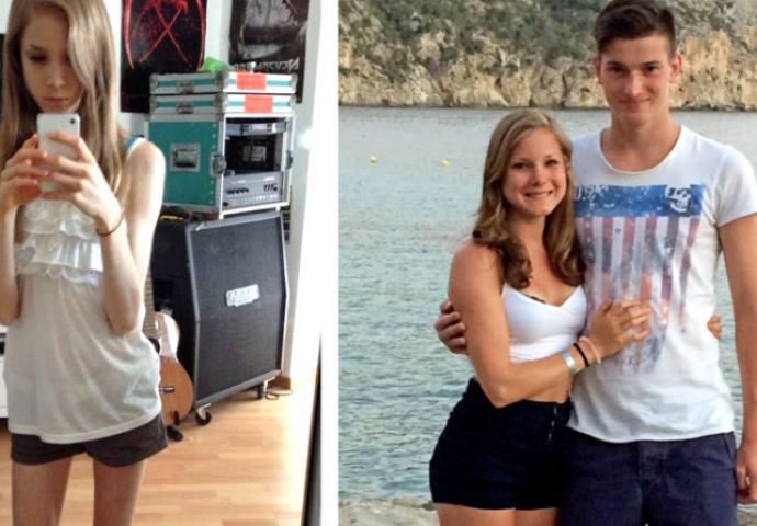 Mršavost joj mogla doći glave: Zbog 39 kalorija dnevno postala je živi kostur (FOTO I VIDEO)