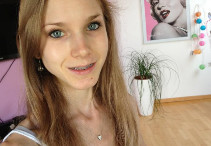 Mršavost joj mogla doći glave: Zbog 39 kalorija dnevno postala je živi kostur (FOTO I VIDEO)