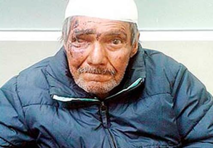 Prije dva mjeseca ovog deku je porodica kremirala a onda se kao duh pojavio sa zavojima na glavi (VIDEO)