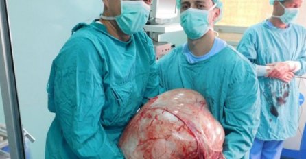 Doktori u Banjaluci izvadili tumor težak 31 kilogram