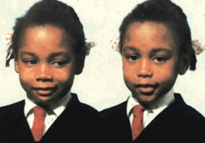 Jezive blizanke: Bile su nerazdvojne, pričale tajnim jezikom i međusobno se pokušale ubiti