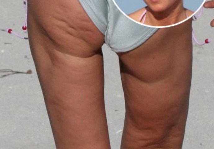 I one muče muku s celulitom: Evo kako poznate dame zaista izgledaju!