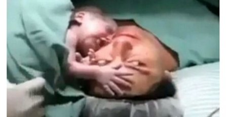 Čudesno: Novorođena beba zagrlila mamu i ne želi se odvojiti od nje (VIDEO)