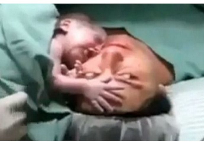 Čudesno: Novorođena beba zagrlila mamu i ne želi se odvojiti od nje (VIDEO)