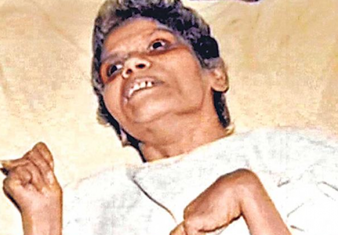 Nakon silovanja, 42 godine živjela kao biljka! Znalo se ko je silovatelj, ali je opet ostao na slobodi (FOTO)