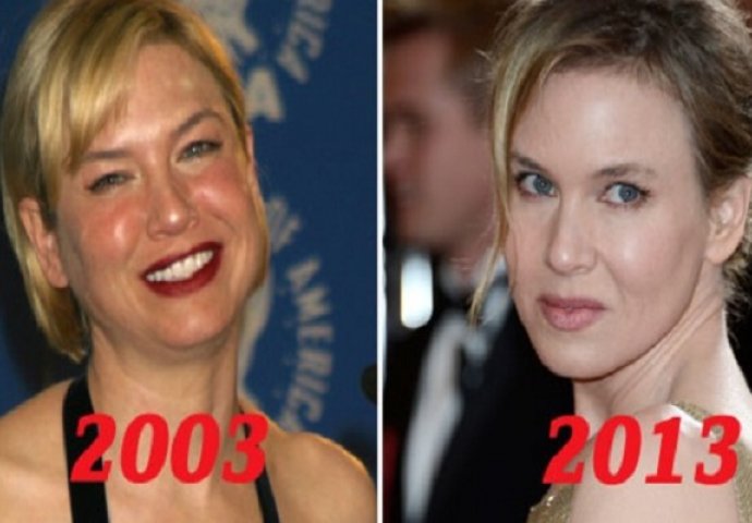  15 godina kasnije: Lice Renee Zellweger koje nećete moći prepoznati