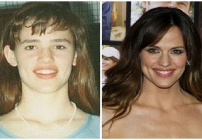 Urnebesne fotografije poznatih ličnosti, sigurno niste znali da su bili štreberi