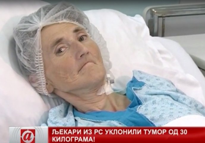 Mislila je da će odlazak doktoru biti njen kraj: Ovo je Banjalučanka  kojoj je izvađen tumor od 31 kilogram (VIDEO)