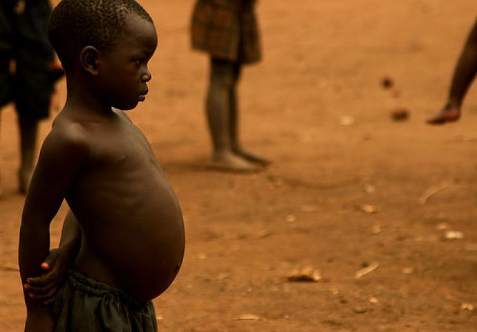 Sirotinjo, i Bogu si teška: Znate li zašto djeca u Africi imaju velik stomak?