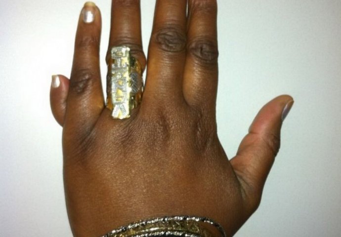 Fotografije ljudi sa 12 prstiju od kojih ćete se naježiti! 