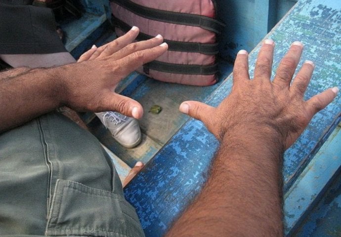 Fotografije ljudi sa 12 prstiju od kojih ćete se naježiti! 