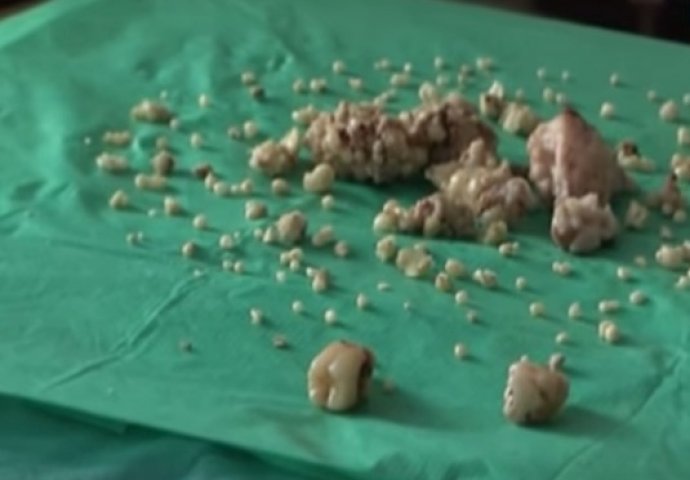 Slučaj ovog tinejdžera je nezapamćen: 'U svojoj 30-godišnjoj karijeri nisam vidio ništa slično'