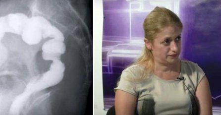 Doktori joj vaginu zašili za debelo crijevo, kad je došla kući shvatila je da nešto nije u redu  (FOTO I VIDEO)