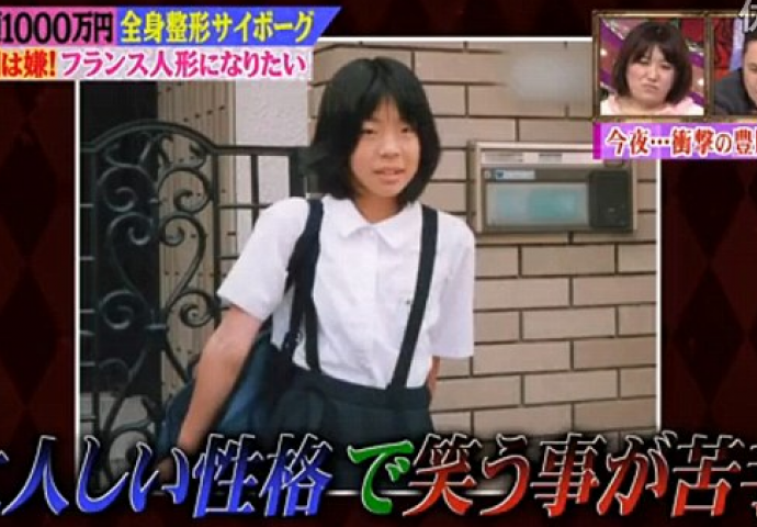 Žena koja je pod nož otišla više od 30 puta: Kako je izgledala prije, ni rođena majka je ne bi poznala (FOTO)