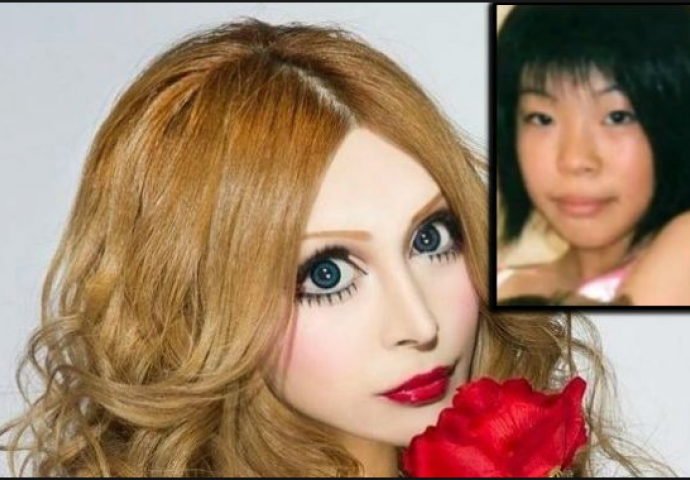 Žena koja je pod nož otišla više od 30 puta: Kako je izgledala prije, ni rođena majka je ne bi poznala (FOTO)