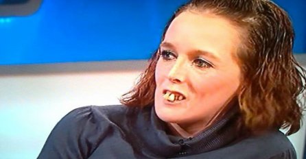 Mnogi ljudi su je zbog loših zubi nazivali "zubata", a onda je svoj izgled totalno transformisala (VIDEO)