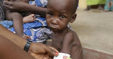 UNICEF: Od gladi u Nigeriji moglo bi umrijeti 75.000 djece