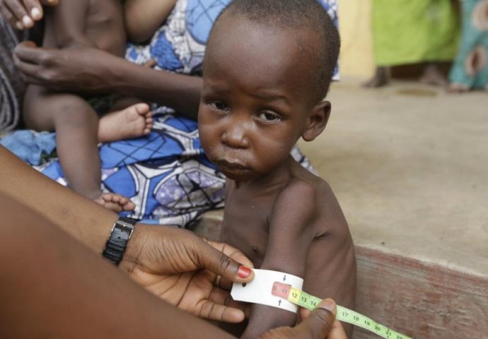 UNICEF: Od gladi u Nigeriji moglo bi umrijeti 75.000 djece