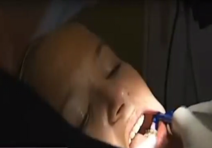 Bio je to normalan pregled kod zubara: Ono što su joj izvadili iz usta može biti upozorenje za sve nas (VIDEO)