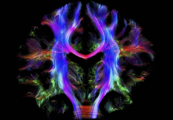 Ovaj test otkriva koliko vam je razvijena desna strana mozga 