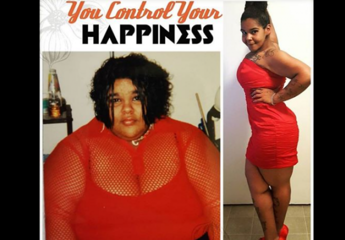 Nakon drastičnog mršavljenja ostalo joj je čak 6,5 kilograma suvišne kože, a onda je zamolila neznance za pomoć (FOTO)