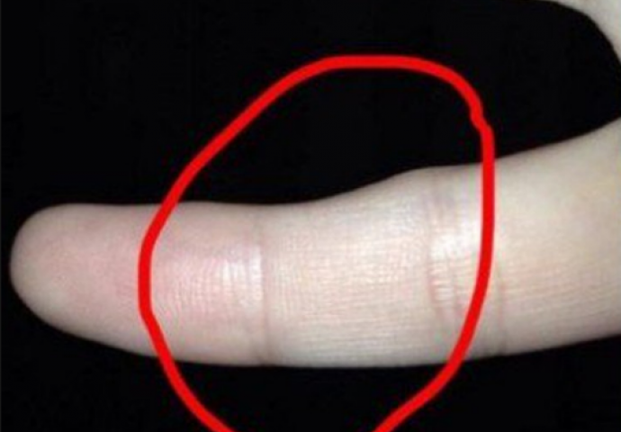 Pogledajte ova 3 dijela malog prsta! Znate li šta ona znače?