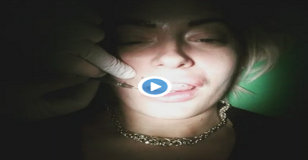 Porno zvijezda šokirala snimkom: Ovako izgleda "remont" silikonskih usana! (VIDEO)