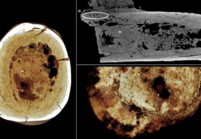 Revolucionarno otkriće: Ispostavilo se da bolujemo od raka već milionima godina!