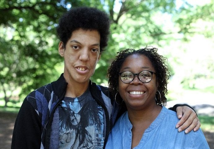 Rekli su joj da čeka potpuno identične blizance: Kada je vidjela jednog od njih, počela je da vrišti od užasa i straha (FOTO) 