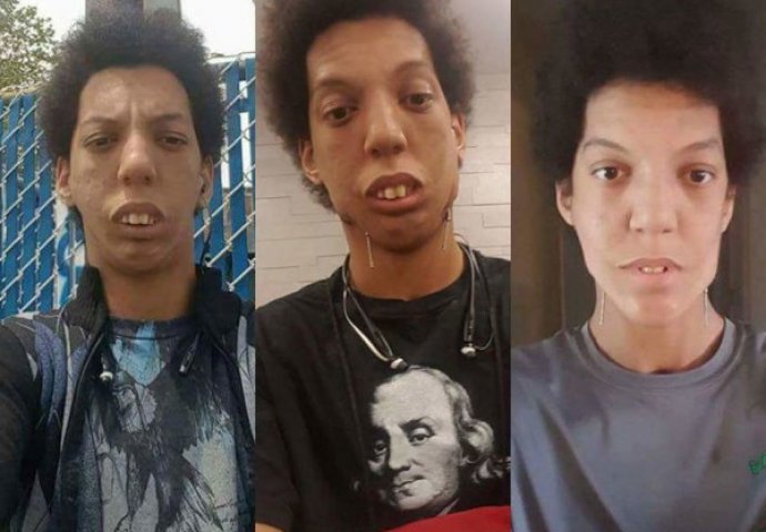 Rekli su joj da čeka potpuno identične blizance: Kada je vidjela jednog od njih, počela je da vrišti od užasa i straha (FOTO) 