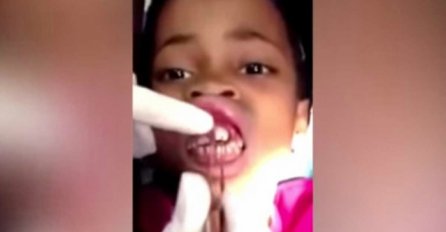 Osjetila je da joj se ”nešto kreće”u usni, a majka je mislila da se šali! Kada je zubar pregledao, zatekao je užas (VIDEO)