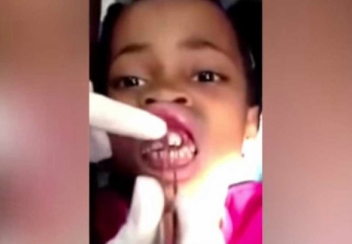 Osjetila je da joj se ”nešto kreće”u usni, a majka je mislila da se šali! Kada je zubar pregledao, zatekao je užas (VIDEO)