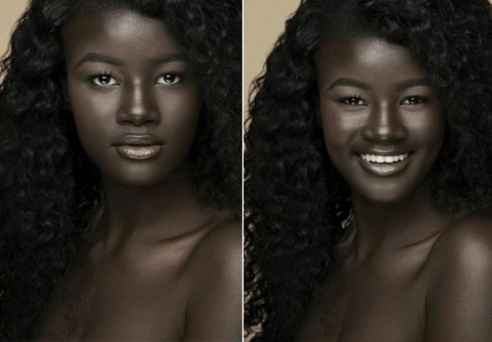 Khoudia Diop: Djevojka koja je maltretirana zbog boje kože danas je uspješan supermodel