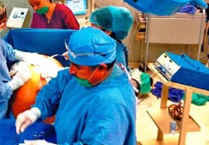 Stomak joj je težio čak 60 kg, a kada je otišla doktoru, zaprepastila se šta su pronašli (FOTO)