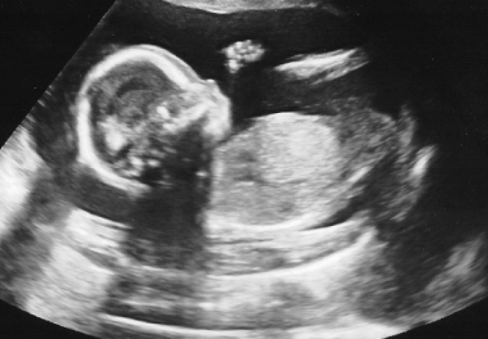 Doktor joj je rekao da je njeno nerođeno dijete bolesno i da treba abortirati: Nakon nekoliko mjeseci saznala je da ju je doktor cijelo vrijeme lagao!