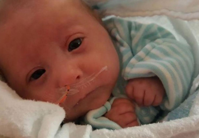 Patuljasti heroj: Ovaj dječak ima 7 mjeseci a tako je malen da nosi odjeću za lutke (FOTO)