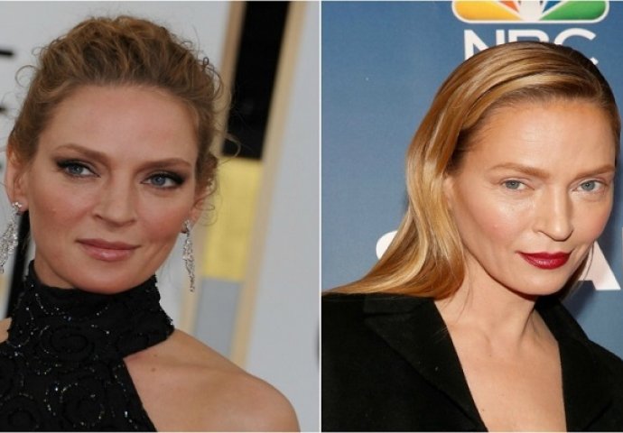 Plastične katastrofe: Slavni ovisnici koji su se potpuno upropastili!