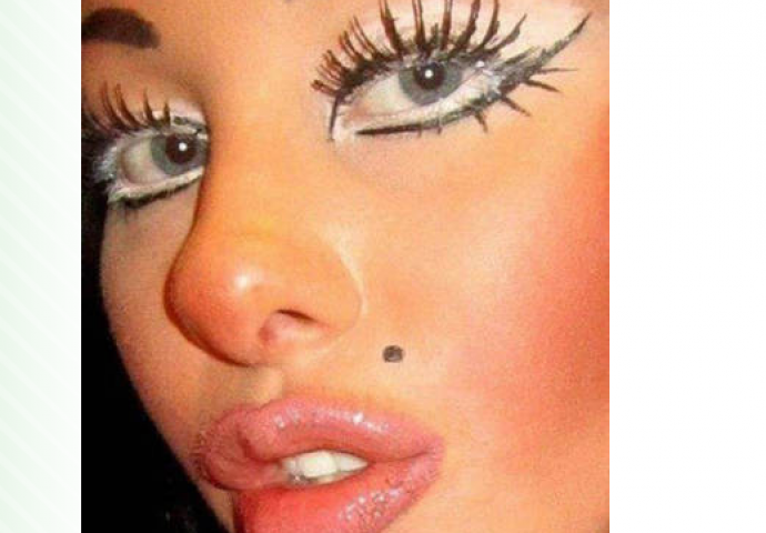 Nakon plastičnih operacija, postale su najveći frikovi na internetu (FOTO)