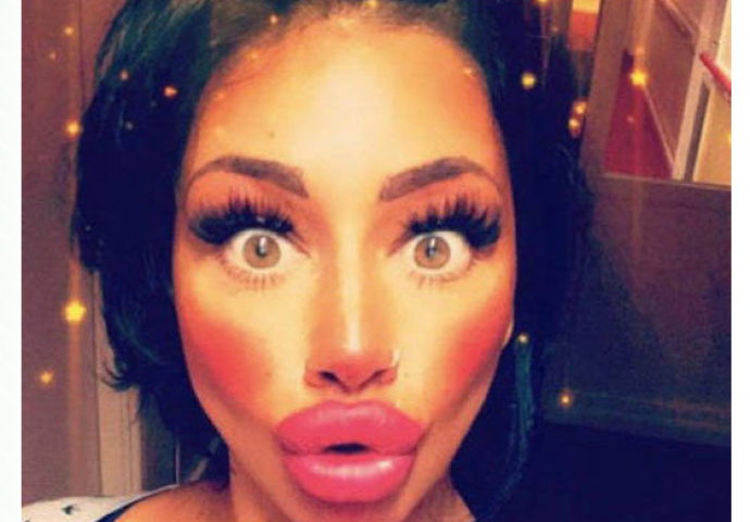 Nakon plastičnih operacija, postale su najveći frikovi na internetu (FOTO)