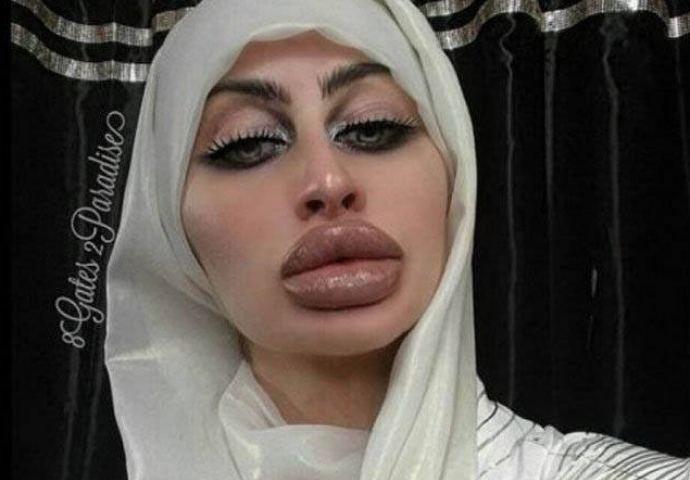 Nakon plastičnih operacija, postale su najveći frikovi na internetu (FOTO)