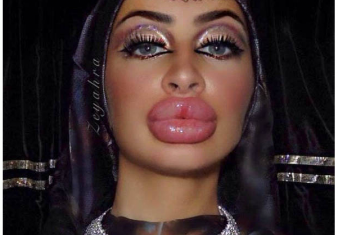 Nakon plastičnih operacija, postale su najveći frikovi na internetu (FOTO)