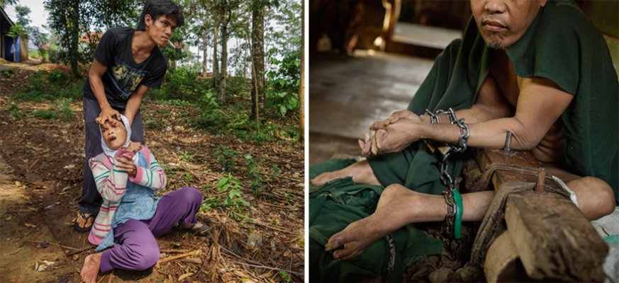 mental-ilness-disorder-indonesia-andrea-star-reese-8