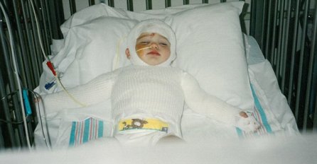 Majka je stavila  bebu u vrelu pećnicu i život joj pretvorila u pakao: Evo kako djevojčica izgleda danas nakon brojnih operacija!