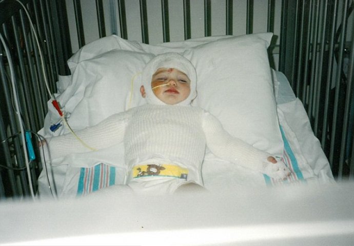 Majka je stavila  bebu u vrelu pećnicu i život joj pretvorila u pakao: Evo kako djevojčica izgleda danas nakon brojnih operacija!