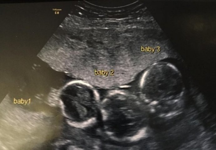 Ni ljekari nisu mogli vjerovati kakav je porođaj imala ova majka: Mnogo kasnije istina je izašla na vidjelo!