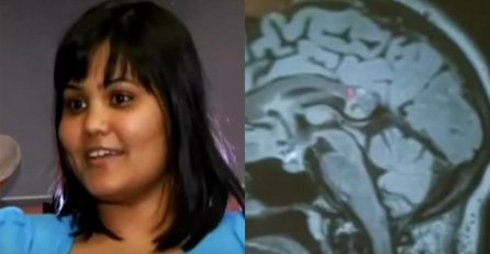 Trebali joj ukloniti tumor na mozgu, a pronašli su nešto sasvim neočekivano (VIDEO)