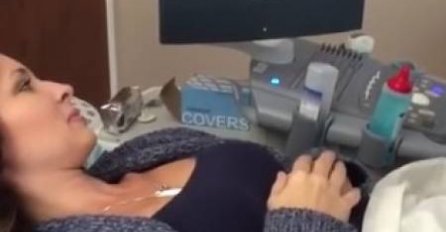 Muž je snimao njihov prvi ultrazvuk: Kada je doktorica pokazala šta se dešava u njenom stomaku, istog momenta je briznula u plač!