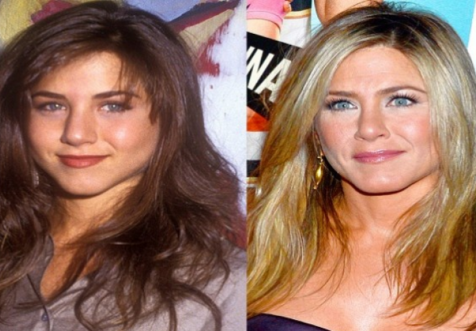 Sredile su nos uz pomoć plastične operacije i to su javno priznale (FOTO)