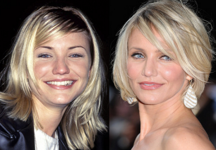 Sredile su nos uz pomoć plastične operacije i to su javno priznale (FOTO)